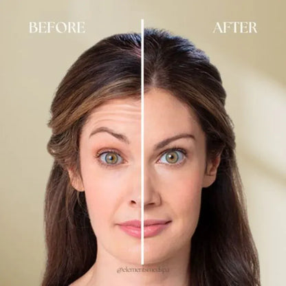 Celimax Retinol Shot Tightening Booster | Advanced Firming & Anti-Aging Serum | Buy 1 Get 1 FREE
